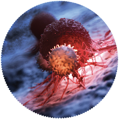 CAR T Cells treatment for cancer