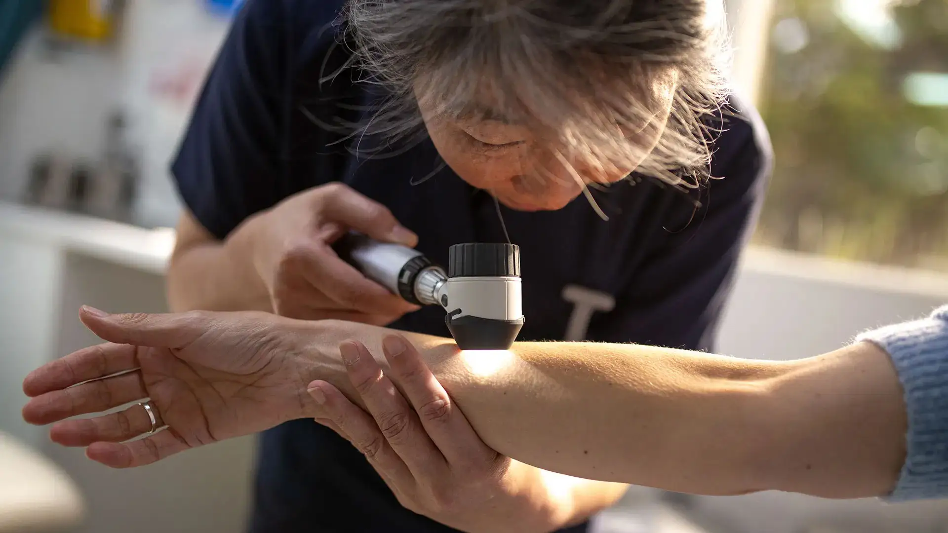 A clinician uses a handheld dermatoscope to examine a patient’s skin for signs of melanoma.